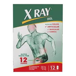 X Ray Dol